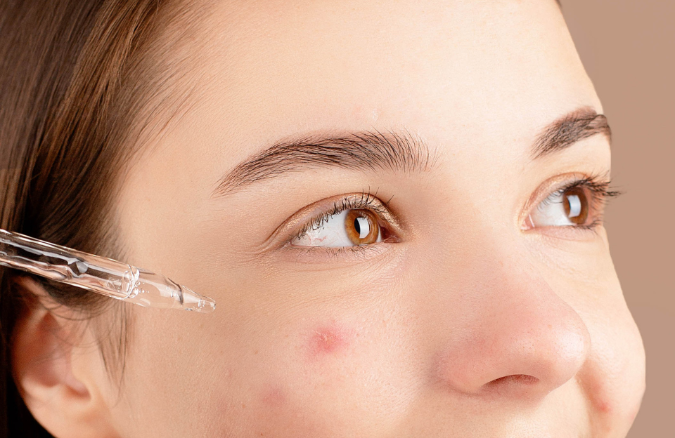 top 10 sữa rửa mặt cho da mụn tốt nhất hiện nay